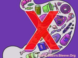 Diet to be Observed During Gastric Sleeve