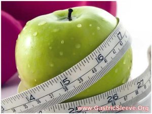 Gastric Sleeve Diet