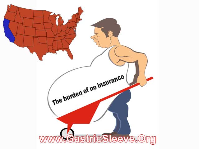 Gastric Sleeve in California for those with no Insurance