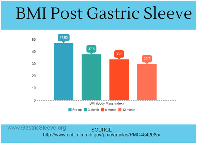 BMI After Gastric Sleeve Surgery